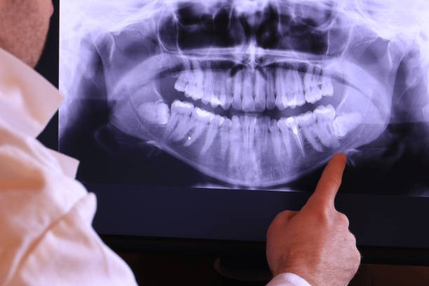 Best Emergency Treatment for Dental Infections or Abscesses in Jasonville, IN