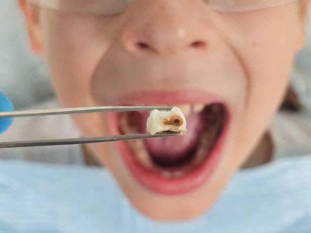 Best Emergency Gum Treatment in Jasonville, IN