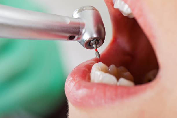 Best Emergency Denture Repair in Jasonville, IN